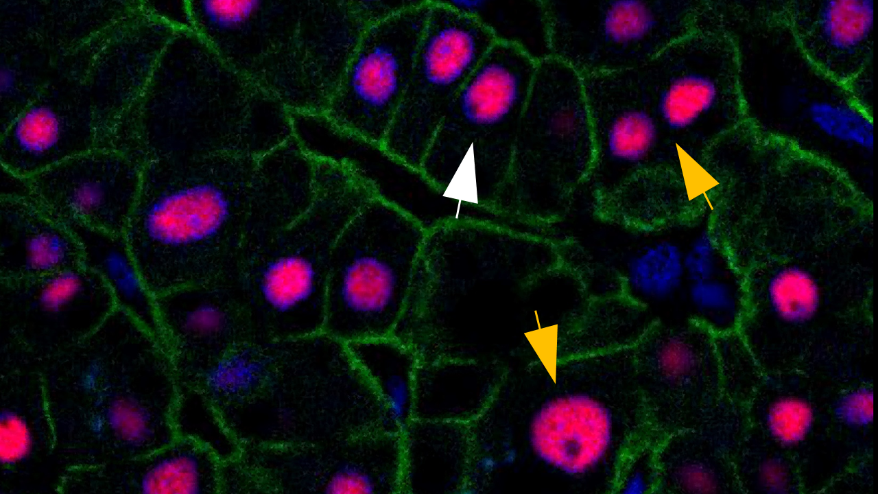 Die meisten Zellen haben nur zwei DNA-Sätze, wie die mit einem weißen Pfeil markierte Zelle. Einige Zellen haben mehr DNA-Sätze, wie die mit gelben Pfeilen markierten Zellen. Diese verschiedenen Zelltypen in der Leber erneuern sich unterschiedlich.