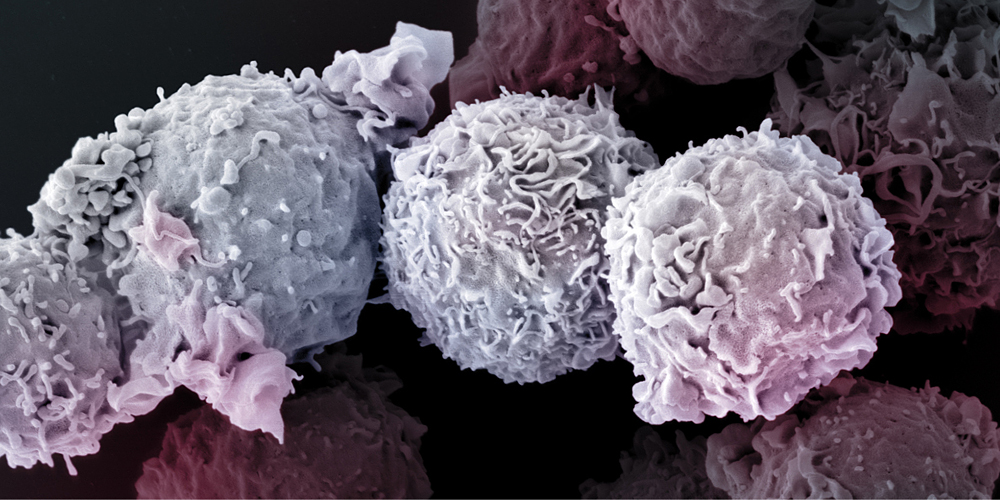 Das Protein Coronin-1 sorgt dafür, dass die T-Zellen unseres Immunsystem lange Zeit überleben, fanden Wissenschaftler an der Uni Basel heraus.